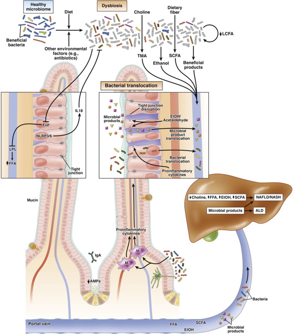 Host–microbiome interactions during liver disease