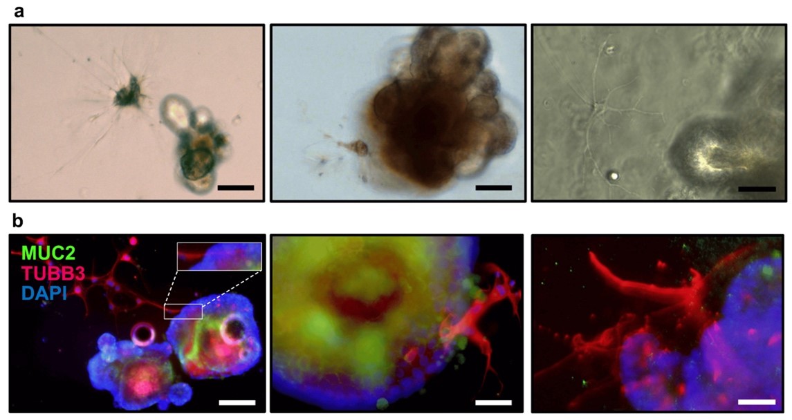 from  Llorente C, Cells, 2024. (*equal contribution)